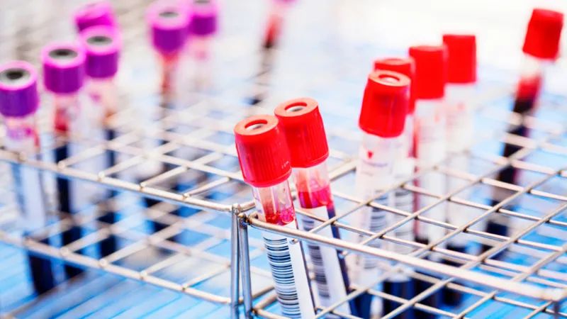 Вирізати ВІЛ із клітин ДНК: вчені заявили про новітню технологію