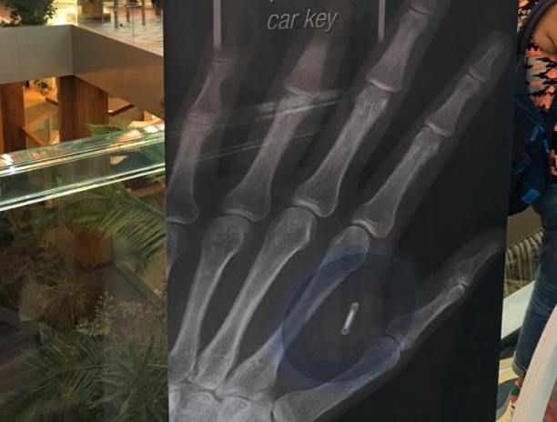 В Одесі почали вживляти собі в руки RFID-чіпи