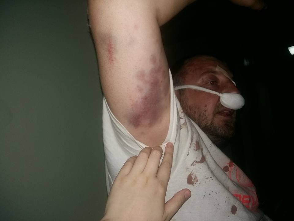 У Києві поліція побила затриманого після конфлікту в кафе екс-АТОвця (відео)