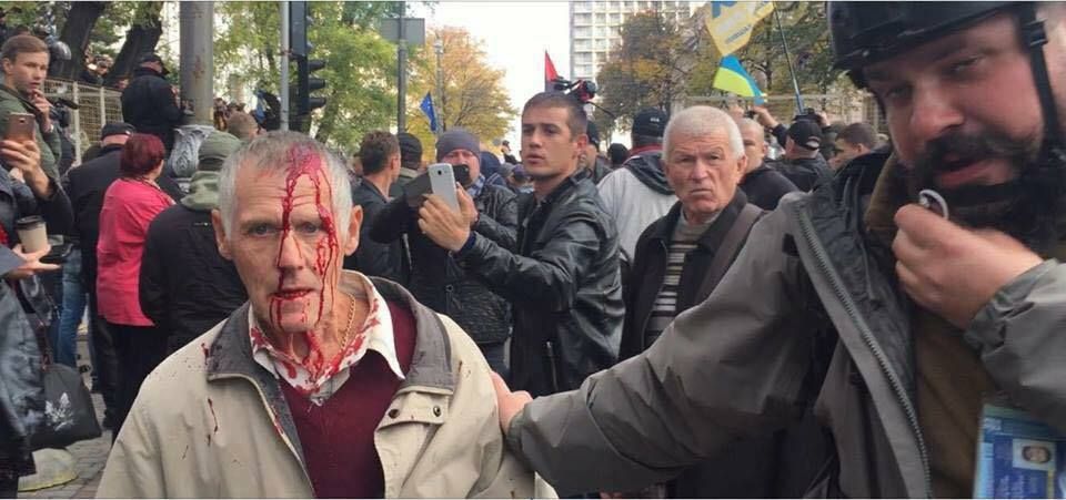 У сутичках під Верховною Радою розбили голову учаснику Євромайдану