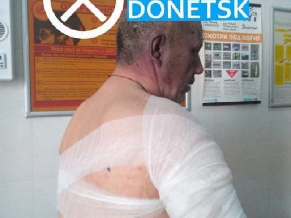 У Донецьку пролунав вибух на з’їзді комуністів: поранено кандидата в главарі «ДНР»