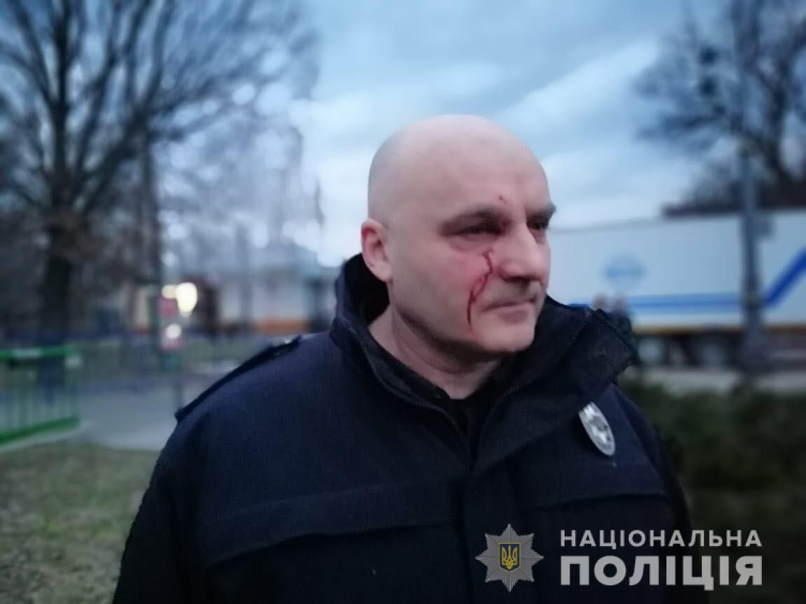 Внаслідок сутичок у Черкасах постраждало 15 поліцейських (відео)