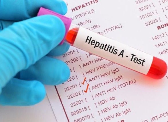Гепатит у чернігівській школі: госпіталізовано 15 учнів
