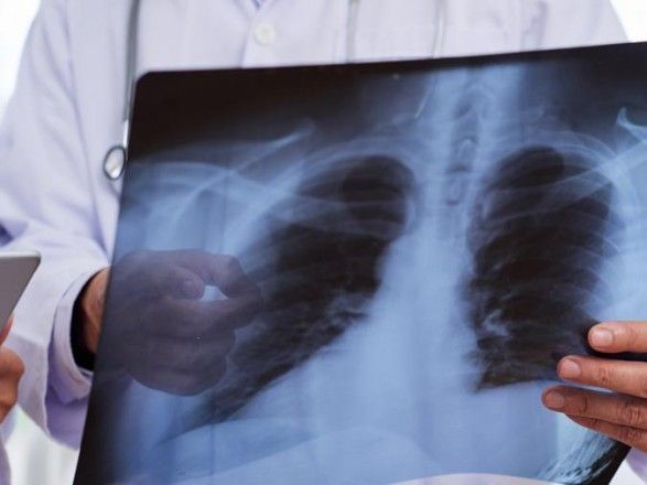 Кількість інфікованих пневмонією нового типу в Китаї зросла до 45