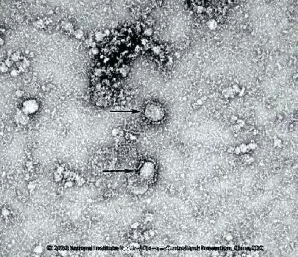 Вчені показали перший знімок коронавірусу 2019 nCoV під мікроскопом