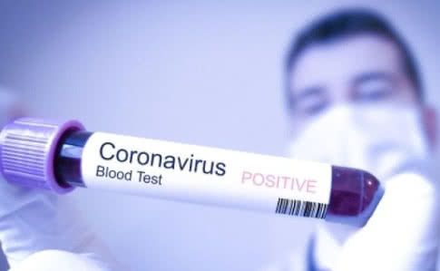В українки в Італії діагностували коронавірус