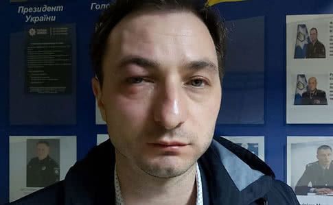 На головлікаря Інституту раку Андрія Безносенка напали у Києві