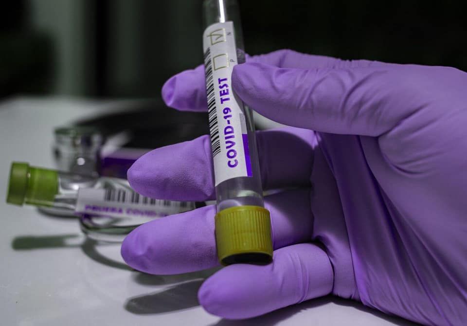 В Україні встановлено абсолютний антирекорд за кількістю хворих на коронавірус