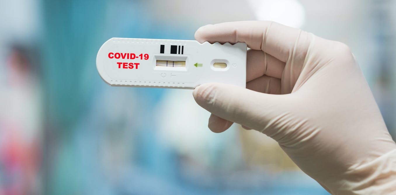Коронавірус: у світі створено ефективніші експрес-тести вартістю $5