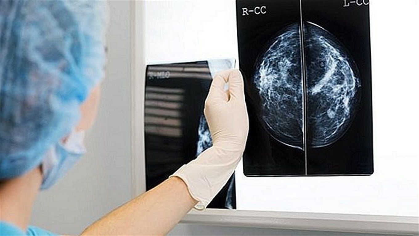 Рожевий жовтень проти раку: українок закликають любити себе і ходити до мамолога