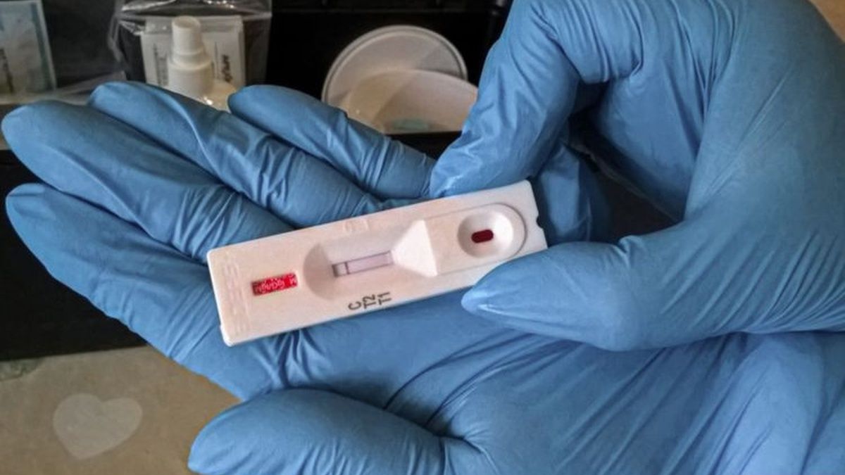 Україна отримала  2 мільйони швидких тестів для визначення коронавіруса