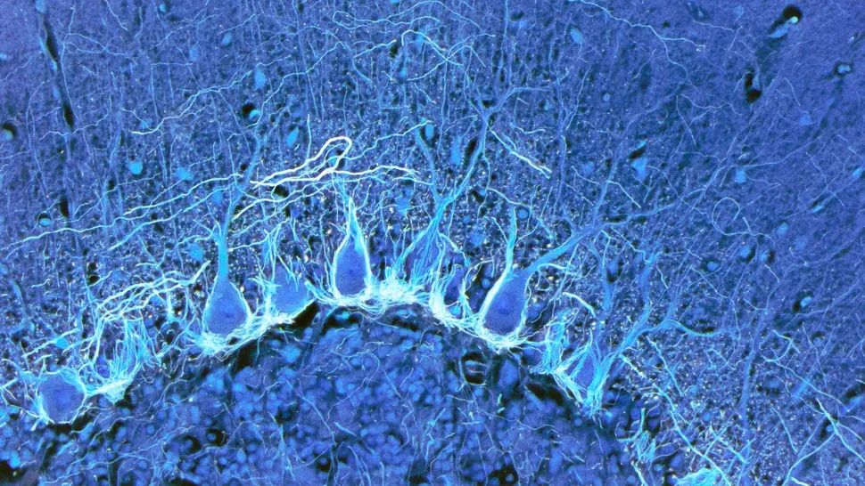 Клітини Пуркіньє (на фото) — це великі нейрони, які знаходяться в мозочку, розташованому на задній і нижній сторонах мозку. У ході нового дослідження вчені виявили безліч нових типів клітин у людському мозку.