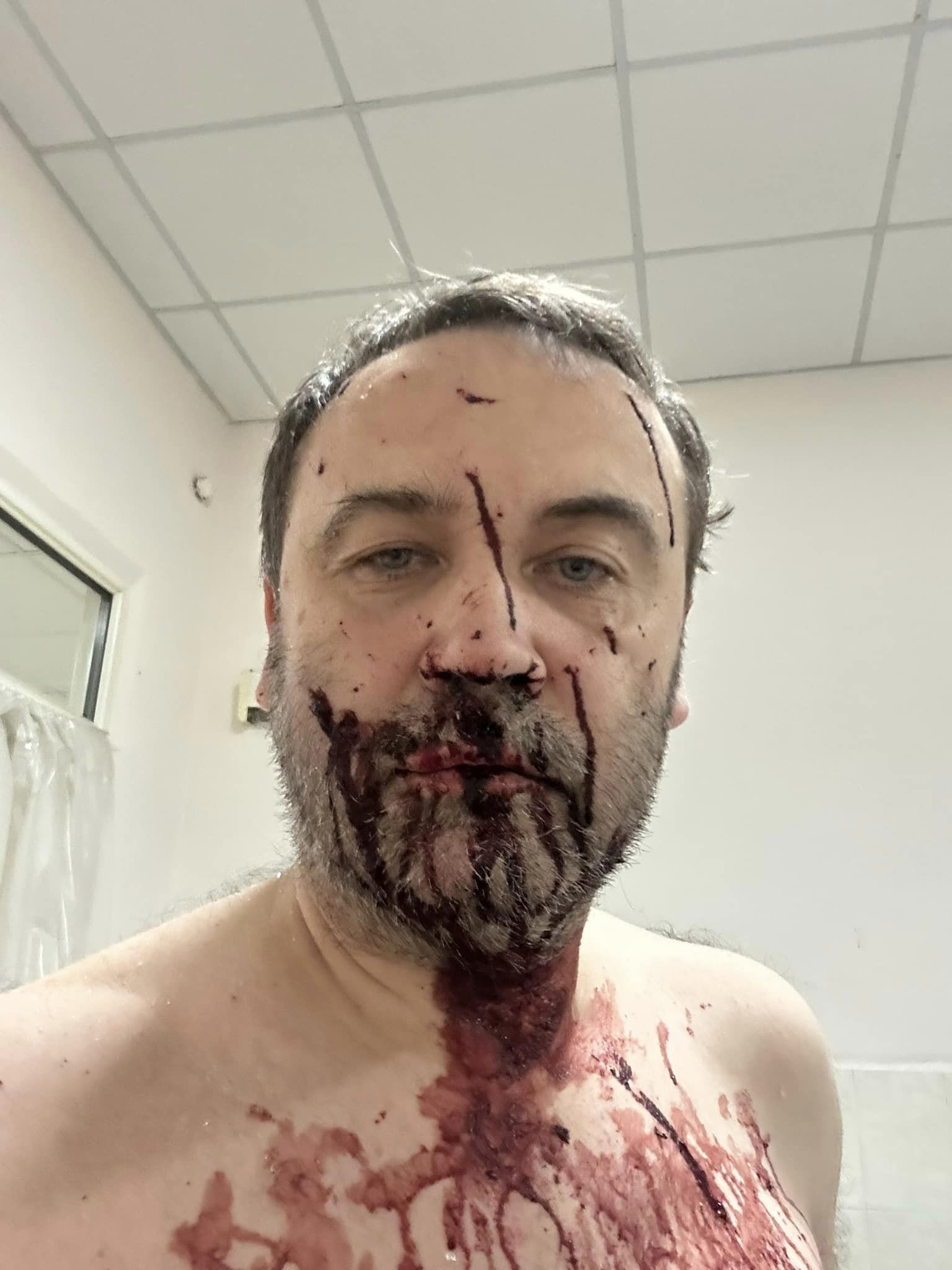Ілля Пономарьов  після отримах поранень.