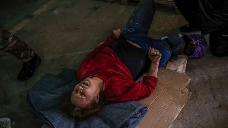 Жінці осколком відірвало ступню: поранену привезли в центр гуманітарної допомогти, де намагалися зупинити кров, але вона померла через пів години.