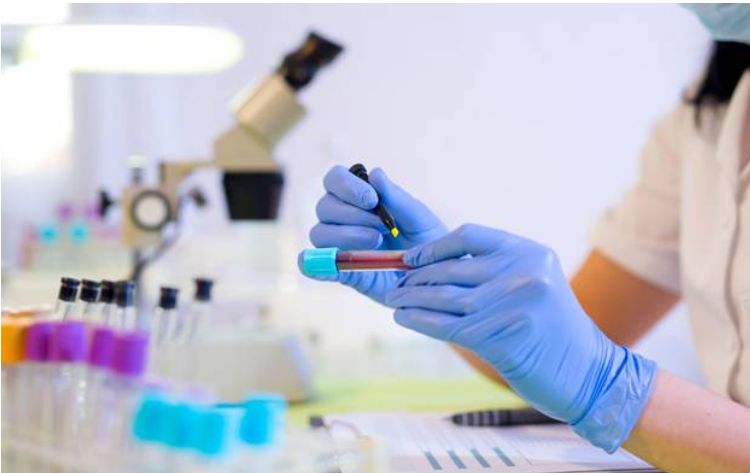 Ліпідограма: призначення та особливості аналізу